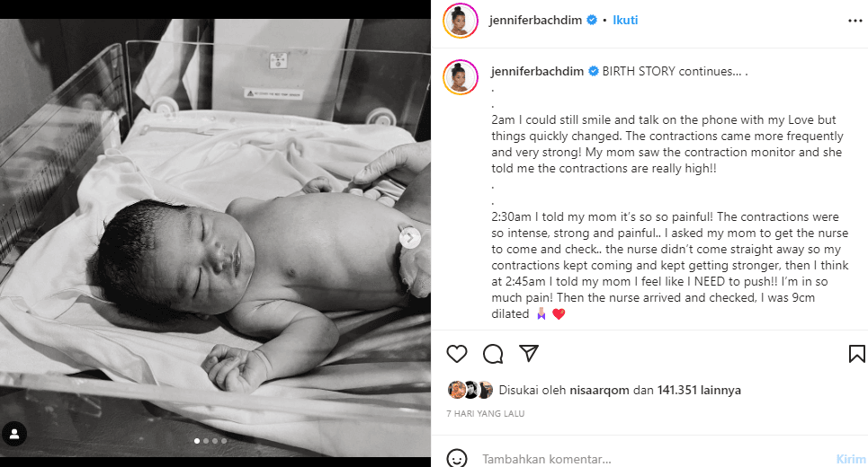 Tali Pusar Anak Jennifer-Irfan Bachdim Dipotong Sendiri oleh Mamanya