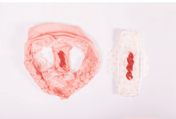 Bayi Bisa Mengalami Menstruasi Palsu